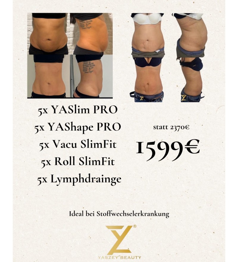 Pakket 4 - Ideaal bij stofwisselingsziekten - (5x) YASlim Pro, YAShape Pro, Vacu SlimFit, Roll SlimFit, Lymfedrainage